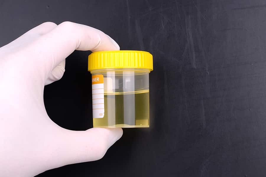 Urine for a drug test